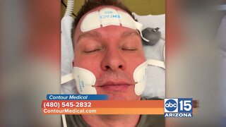 Contour Medical can give you a facelift and get rid of wrinkles WITHOUT using needles!