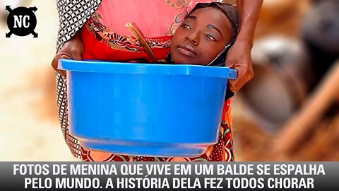 Fotos De Menina Que Vive Em Um Balde Se Espalha Pelo Mundo. A História Dela Fez Todos Chorar