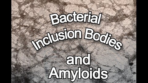 Bacterial inclusive Bodies and Amyloids