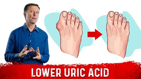 4 Ways to Neutralize Uric Acid