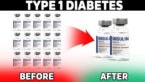 Type 1 Diabetics MUST Do This to Reduce Insulin