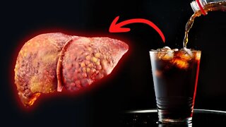 The Dark Side of Diet Soda That Nobody Talks About