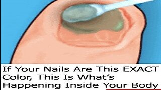 If Your Nails Are This EXACT Color, This Is What's Happening Inside Your Body (Do This Now)