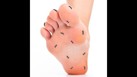 Beat Neuropathy with Complete Health Chiropractic #neuropathy #neuropathytreatment #chiro