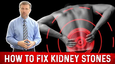 What causes Kidney Stones & It's Treatment by Dr.Berg