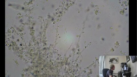 Kefir Probiotic Ferment under the Microscope! Yah Whey!