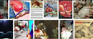 U.S. Harvesting CHILDRENS Organs In Ukraine. Why Western FASCIST Mercenaries Fight For Ukraine