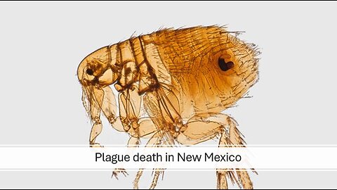 Plague death in New Mexico