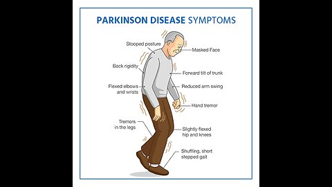 Parkinson Diseases,an astrological analysis