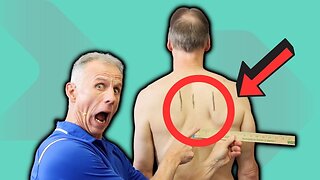 Is Your Shoulder Blade OUT Of Place? 4 Tests