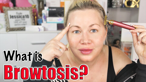 What is Browtosis? And what you can do to fix it! | Code Jessica10 saves you 10% off
