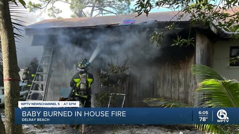 Baby burned in Delray Beach house fire