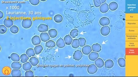 Covid Vaccine Analysis Working Group Microscopy & La Quinta Columna