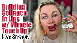 Building Collagen with Miracle L in Lips, AceCosm | Code Jessica10 Saves you Money $$$