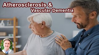 Those With Atherosclerosis Are More Likely To Have Vascular Dementia