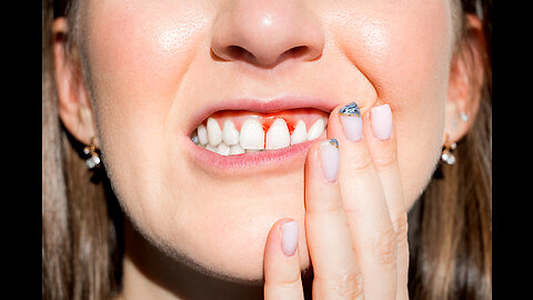 If You Have Gum Disease Or Tooth Decay, Do This Immediately (Genius!)