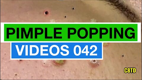 Satisfying Pimple Popping Videos 042