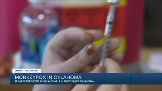 11 cases of monkeypox reported in Oklahoma