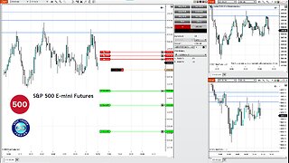 Live Scalp Trade: -$1500 in Seconds! | ES Futures