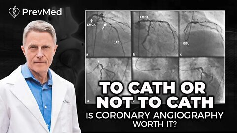 To Cath or Not to Cath - Is Coronary Angiography Worth It?