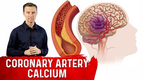 How to Read a Coronary Artery Calcium (CAC) Score