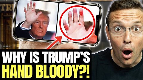 Reporter Asks Trump About His BLOODY Red Hand, Answer Makes Room ERUPT 🤣🔥