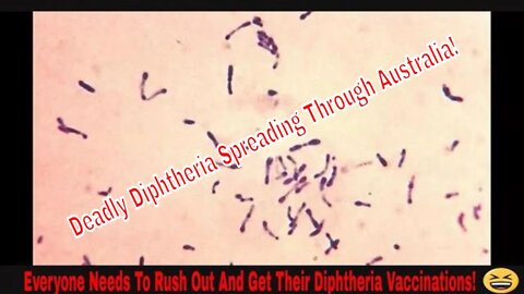 Diphtheria Spreading In Australia Not Seen In 100 Years! #Vaccinations