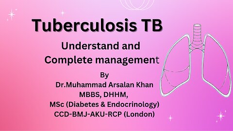 Tuberculosis TB Understand and Complete management