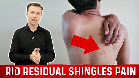 Get Rid of Shingles Pain Fast – Dr.Berg