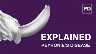 Peyronie’s Disease Explained: Causes, Symptoms and Treatment of Peyronie's Disease | Mansmatters