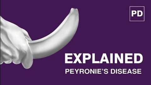 Peyronie’s Disease Explained: Causes, Symptoms and Treatment of Peyronie's Disease | Mansmatters