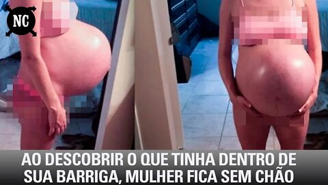 Ao Descobrir O Que Tinha Dentro De Sua Barriga, Mulher Fica Sem Chão