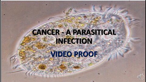 Video Proof: Cancer is Caused by Parasites