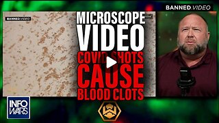 Microscope Video: Pathologist Proves COVID Shot Causes Blood Clots