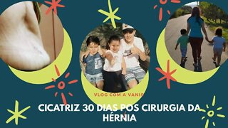 Como esta minha cicatriz da Hérnia com 30 dias- Vlog Rotina