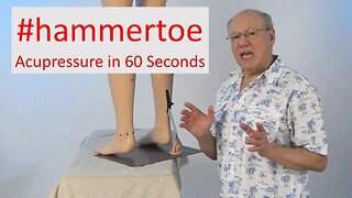 Toe-Tastic Solutions: Acupressure Technique for Hammertoe Relief