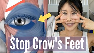 Eliminate Crow's Feet