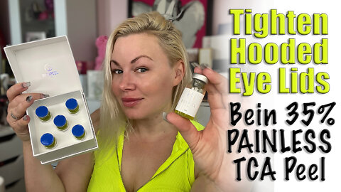 Tighten Hooded Eye Lids with Bein 35% TCA Peel from AceCosm | Code Jessica10 saves you Money $