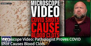 Microscope Video: Pathologist Proves COVID Shot Causes Blood Clots