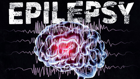 How to END Seizures (Epilepsy) Once and For All