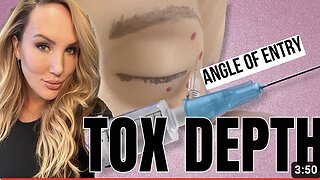 Tox Depth & Angle of Entry // Brow Lift, Crows feet, Bunny Lines