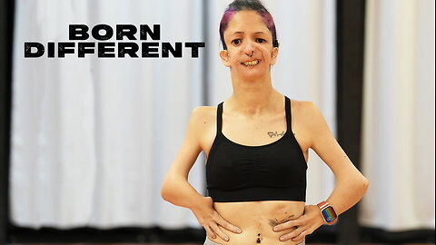 Only 93 People In The World Have My Condition | BORN DIFFERENT