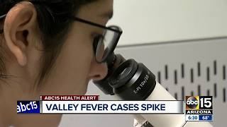 Valley Fever cases spike