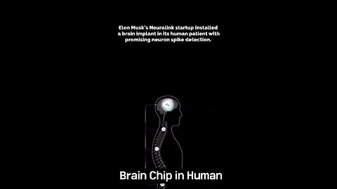 Brain Chip in Human