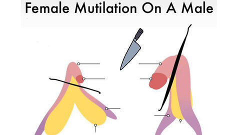 Female Circumcision On A Male
