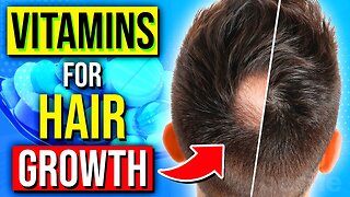 7 BEST Vitamins & Nutrients For Instant HAIR GROWTH | Health Advice