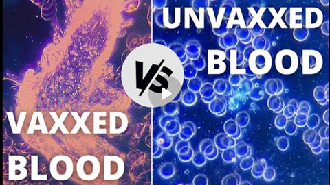 VAXXED BLOOD vs. UNVAXXED BLOOD