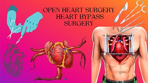Open Heart Surgery 3d Animation | CABG Surgery | Heart Bypass Surgery | Bypass Heart Surgery Risk