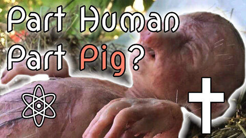 Is Pig to Human Transplantation Immoral? Let me Explain!|✝⚛