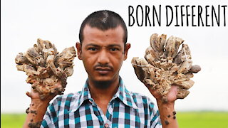 They Call Me 'The Tree Man' | BORN DIFFERENT